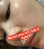 BỘ PHỤC HỒI CHUYÊN SÂU CHO DA MỎNG YẾU 